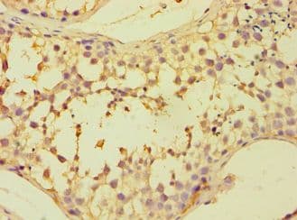 Polyclonal Rabbit anti-Human CAPZB / CAPZ Beta Antibody (aa1-272, IHC, WB)