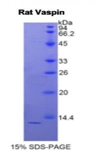Rat SERPINA12 / Vaspin Protein (Recombinant His)