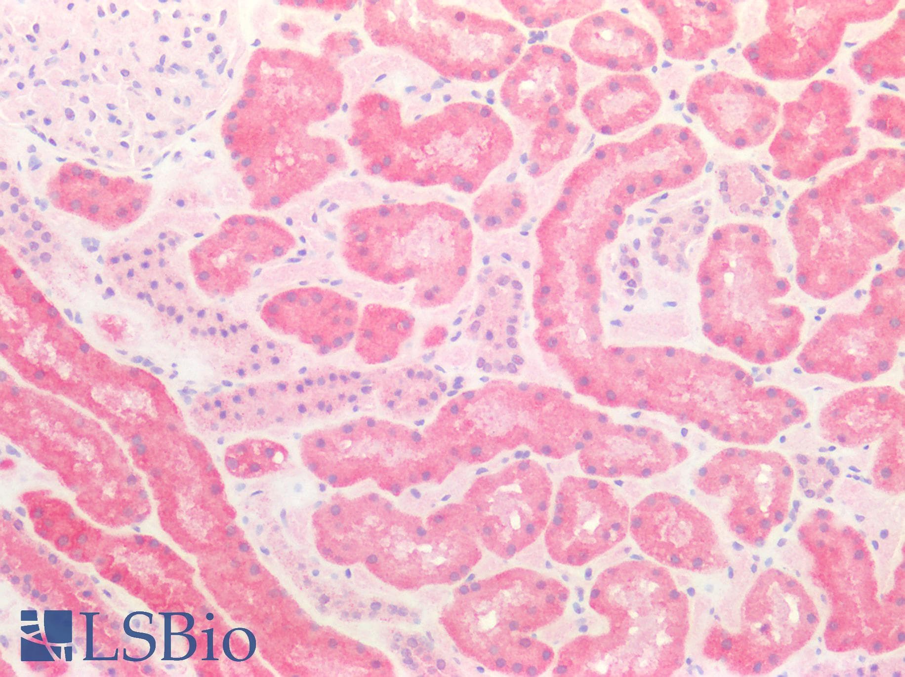 PathPlus™ BCKDHA / BCKDE1A Antibody