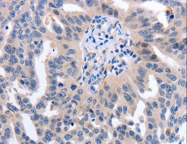 Polyclonal Rabbit anti-Human YWHAQ / 14-3-3 Theta Antibody (IHC, WB)