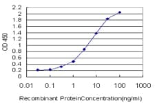 IHC-plus™ Monoclonal Mouse anti-Human ACTN4 Antibody (clone 4D10, IHC, IF, WB)