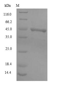BK Polyomavirus Capsid Protein VP1 (Recombinant 10His, N-terminus + Myc, C-terminus)