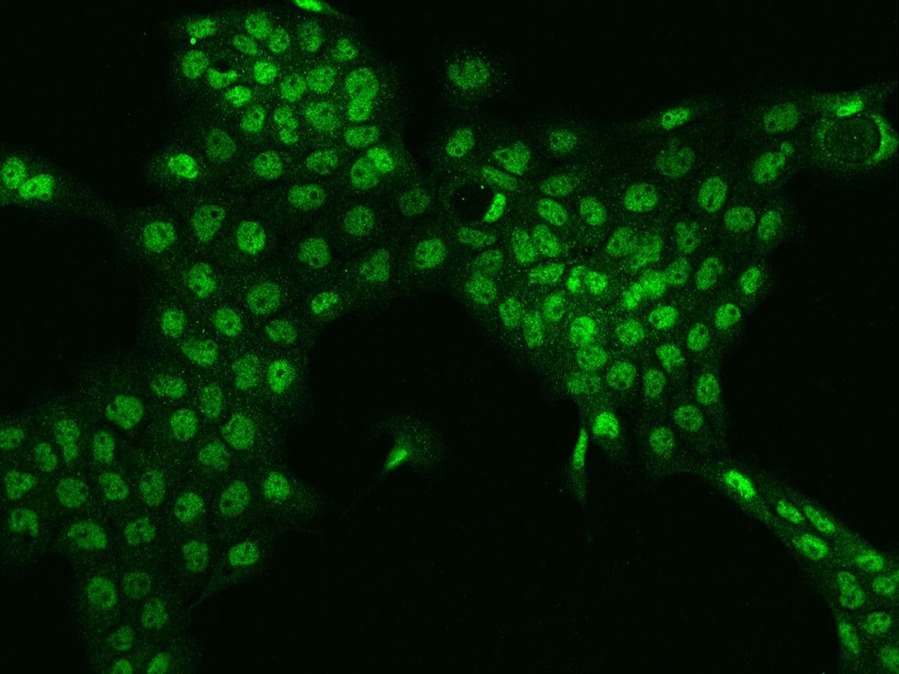 TESK2 Antibody