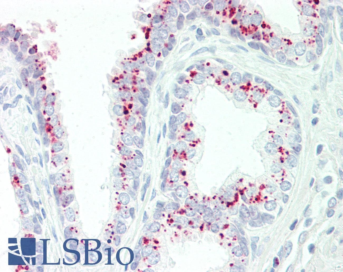 IHC-plus™ GAA / Alpha-Glucosidase, Acid Antibody (aa174-203)