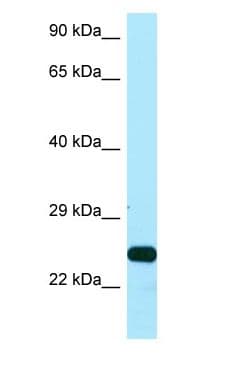 Polyclonal Rabbit anti-Human SSU72 Antibody (C-Terminus, WB)