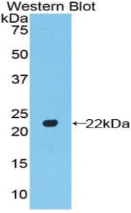 POTEG Antibody (aa146-306, FITC)