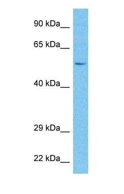 CMPK2 Antibody (C-Terminus)
