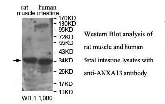 ANXA13 / Annexin XIII Antibody (aa100-316)