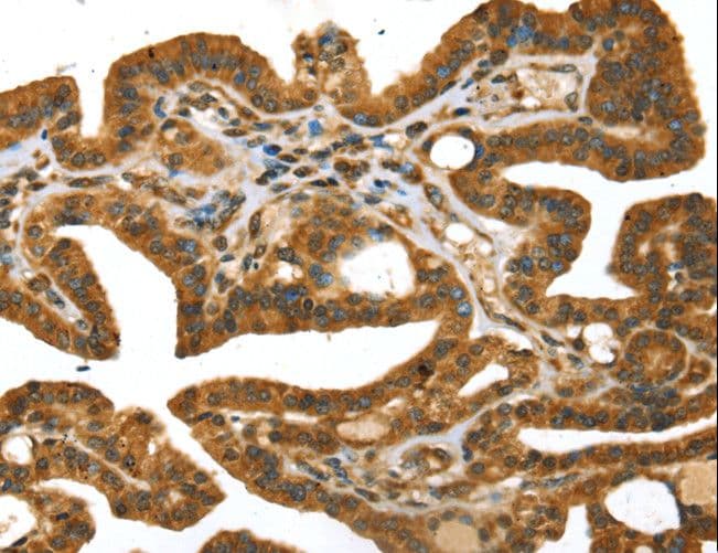 Polyclonal Rabbit anti-Human STX11 / Syntaxin 11 Antibody (IHC, WB)