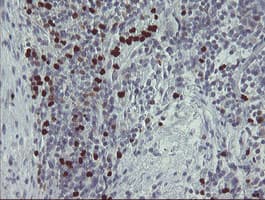 PADI4 / PAD4 Antibody (clone OTI5E7)
