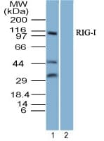 IHC-plus™ DDX58 / RIG-1 / RIG-I Antibody (aa200-250)