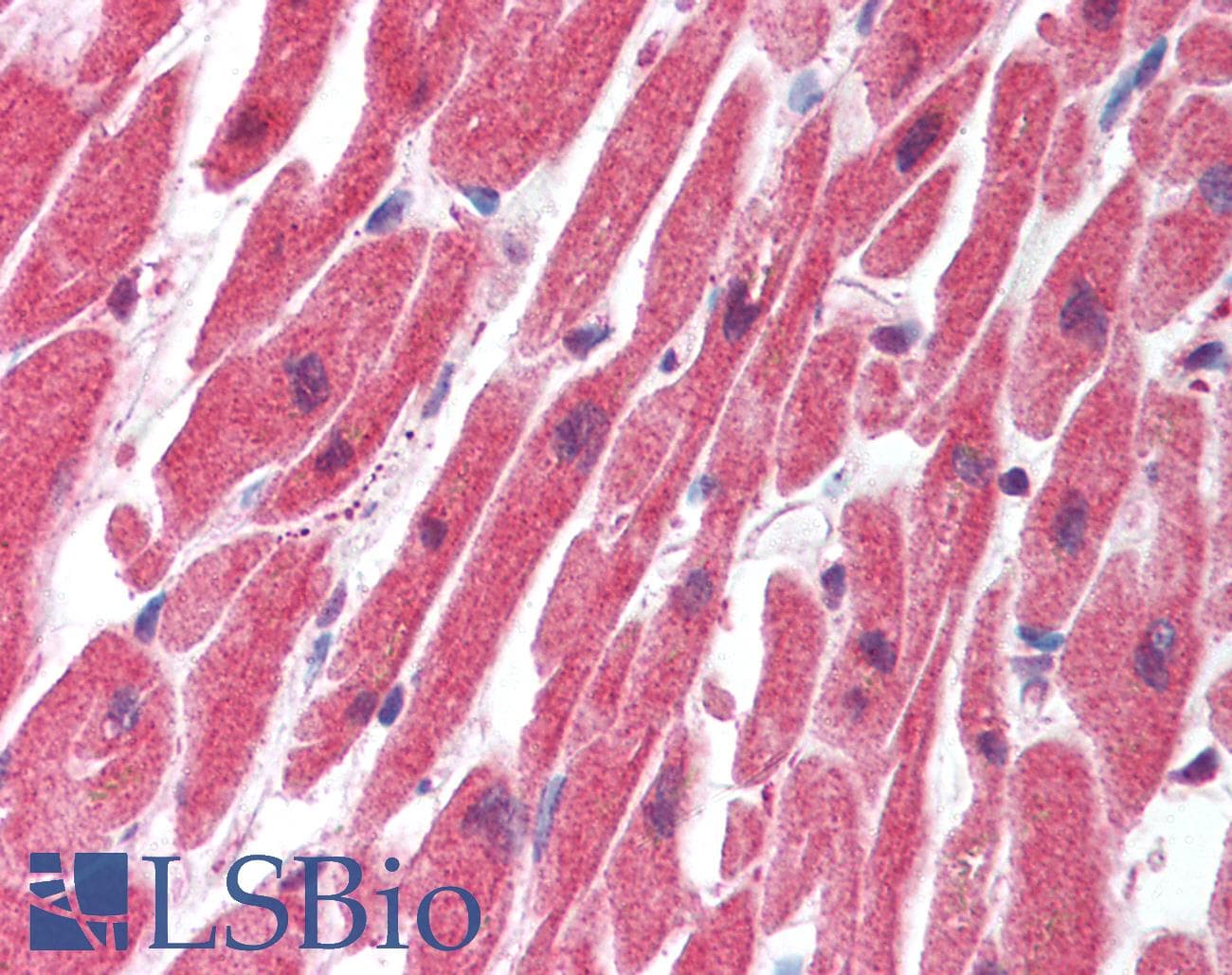 SERTAD1 / TRIP-Br1 / SEI-1 Antibody (N-Terminus)