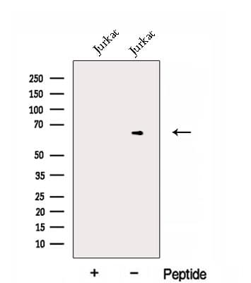 Polyclonal Rabbit anti-Human EXTL3 Antibody (WB)