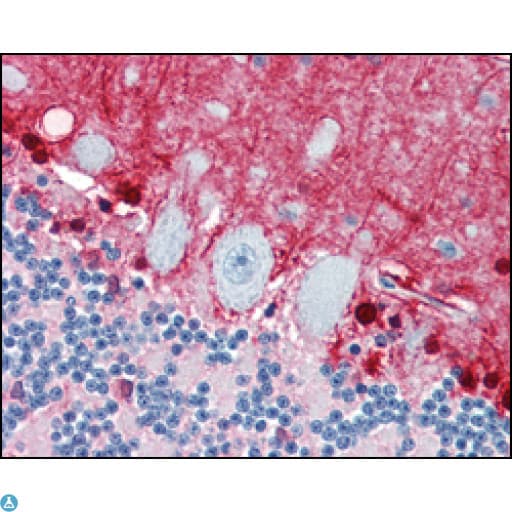 S100A1 / S100-A1 Antibody
