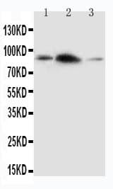 Polyclonal Rabbit anti-Human APLP2 Antibody (C-Terminus, IHC, WB)
