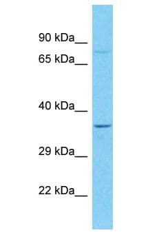 Polyclonal Rabbit anti-Human HOXC13 Antibody (aa141-190, WB)