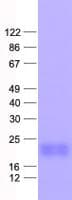 Human NPPA / ANP Protein (Recombinant His, N-Terminal)