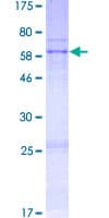Human WNT9B / WNT15 Protein (Recombinant GST)