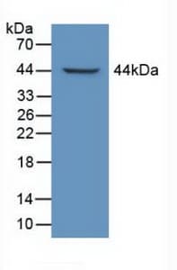 LTBP1 / LTBP-1 Antibody (aa1415-1712)