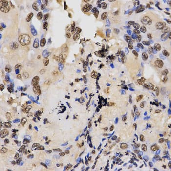 Histone H3 Antibody (Di-Methyl-Lys36)