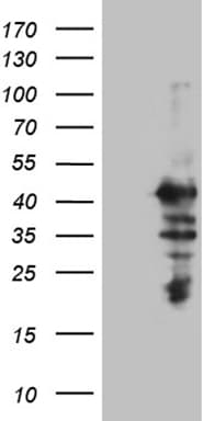 Monoclonal Mouse anti-Human MAGEB2 Antibody (clone OTI5C10, Carrier-free, aa1-224, WB)
