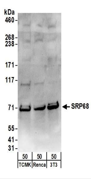 Polyclonal Rabbit anti-Human SRP68 Antibody (aa1-50, WB)