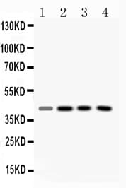 VASP Antibody