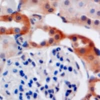 C4BPB / C4BP Beta Antibody