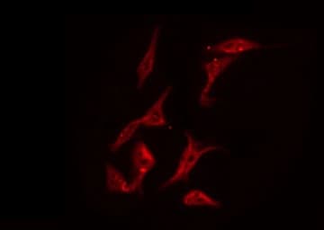 PRKCD / PKC-Delta Antibody