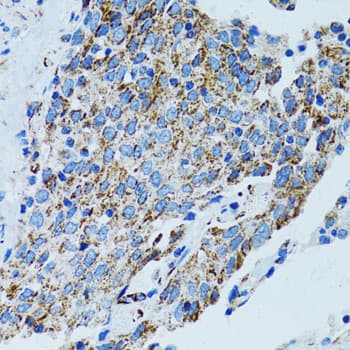Polyclonal Rabbit anti-Human MRPL28 Antibody (IHC, IF, WB)
