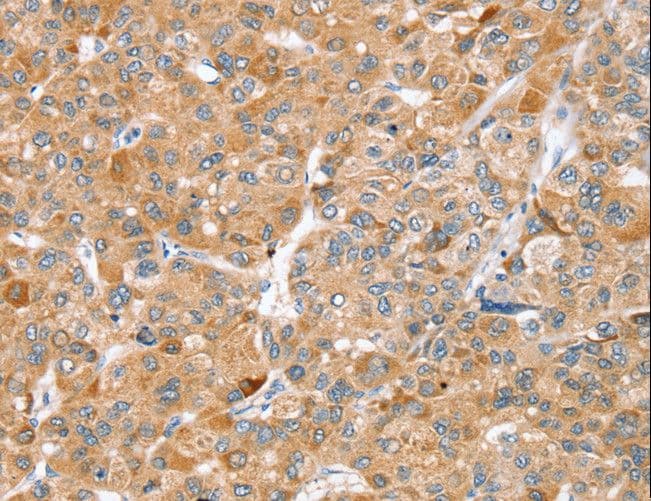 ZFP36L2 Antibody