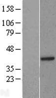 BRCC3 / BRCC36 Protein (Over-Expression Lysate Myc-DDK (Flag))
