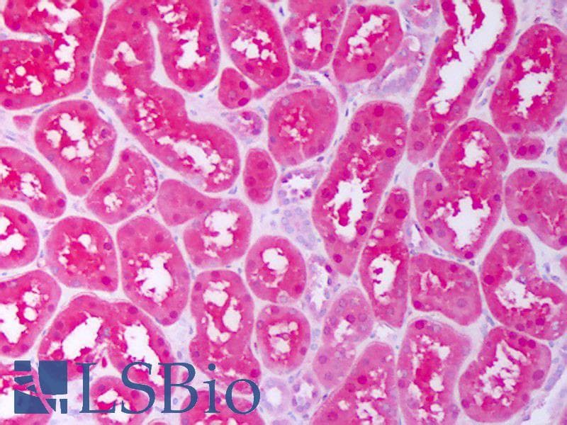 IHC-plus™ SDF1 / CXCL12 Antibody
