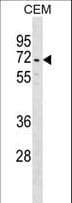 DYTN Antibody (aa419-447)