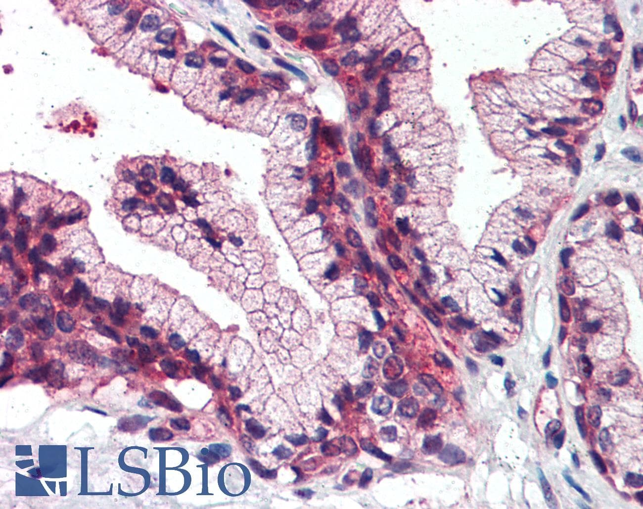 IHC-plus™ SLC39A14 / ZIP14 Antibody (Cytoplasmic Domain)