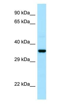 CAPZA1 / CAPZ Alpha 1 Antibody (N-Terminus)