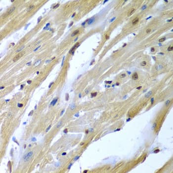 Polyclonal Rabbit anti-Human TUSC2 / FUS1 Antibody (IHC, IF, WB)