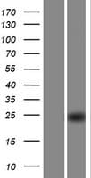 PDDC1 Protein (Over-Expression Lysate Myc-DDK (Flag))