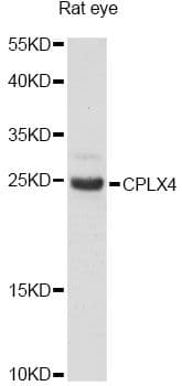 CPLX4 / Complexin IV Antibody