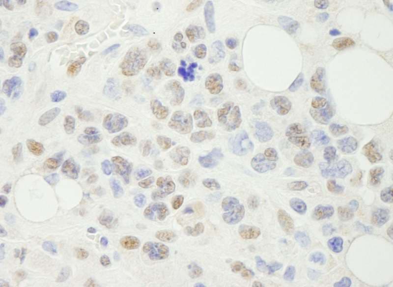 Polyclonal Rabbit anti-Human NFYA Antibody (aa333-347, IHC)