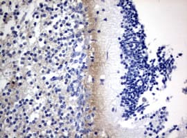 Monoclonal Mouse anti-Human VILIP / VSNL1 Antibody (clone OTI7E11, IHC, WB)