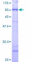 Human CCT6B Protein (Recombinant GST)