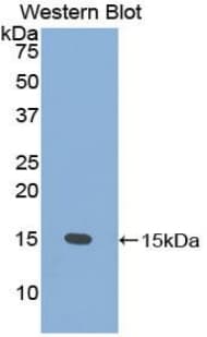 PSCA Antibody (aa22-95)