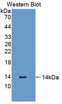 S100A12 Antibody (aa2-92)