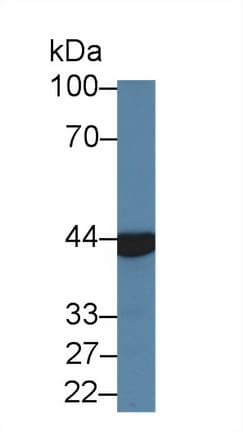 ACY1 / Aminoacylase 1 Antibody (aa2-408, APC)
