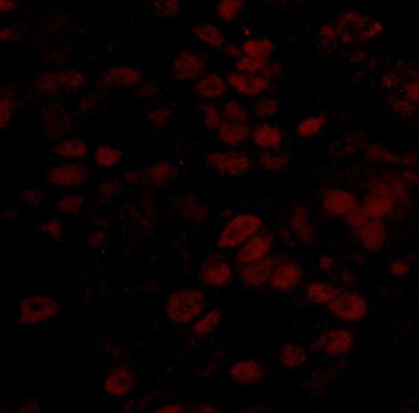 Polyclonal Rabbit anti-Human BCCIP Antibody (aa300-350, IHC, IF)