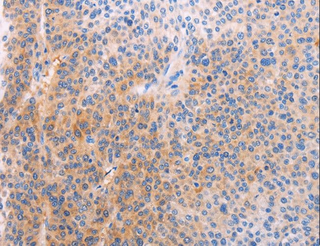 ADHFE1 Antibody
