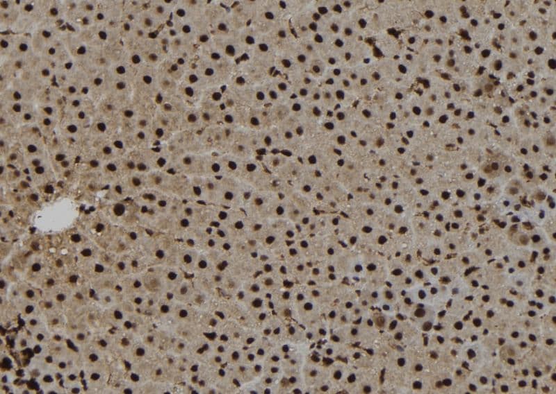 NAT10 Antibody