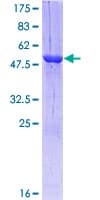 Human RAB3A Protein (Recombinant GST)