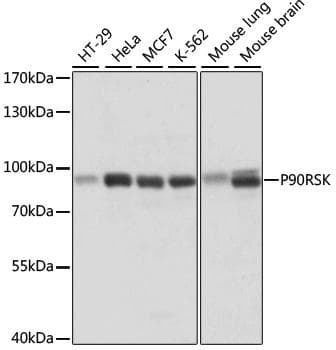 RPS6KA1 / RSK1 Antibody